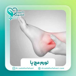 ادم و تورم مچ پا در اثر مصرف قرص (آملودیپین)