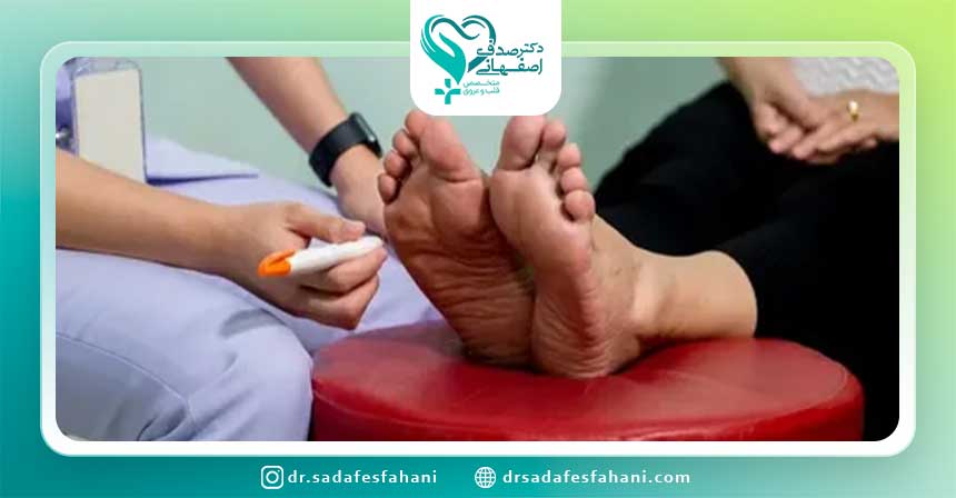 علائم نوروپاتی دیابتی