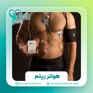 هولتر ریتم