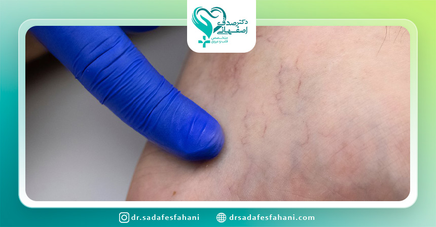 نتیجه گیری و راهنمای مراجعه به پزشک