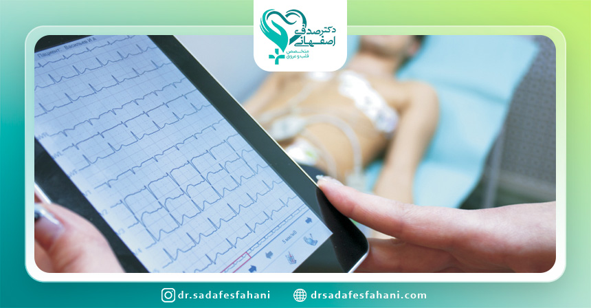 انواع دیگر EKG