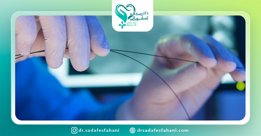 تغذیه بعد از آنژیوگرافی