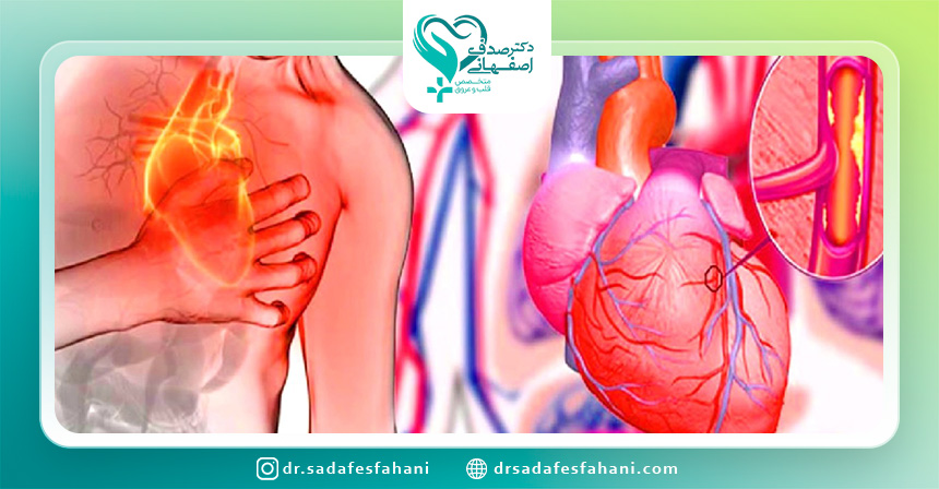 انواع آنژیوگرافی