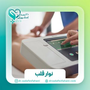 نوار قلب