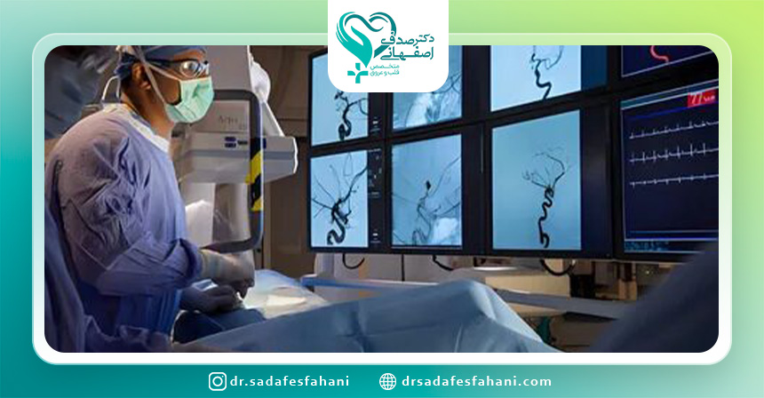 بعد از آنژیوگرافی