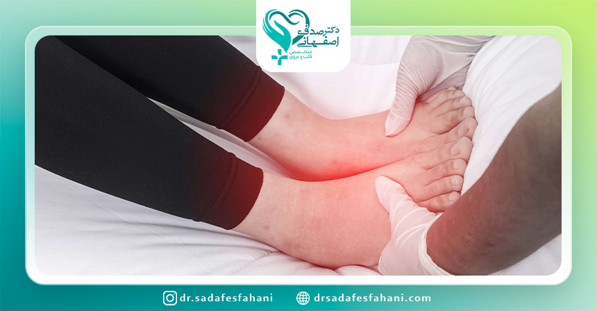 تشخیص علت ورم اندامها و ادم محیطی چگونه انجام می شود؟