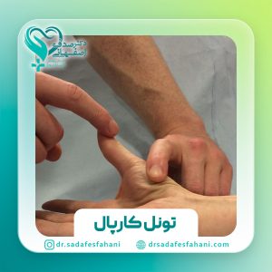 سندروم تونل کارپال چیست؟