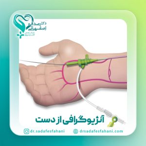 آنژیوگرافی از دست