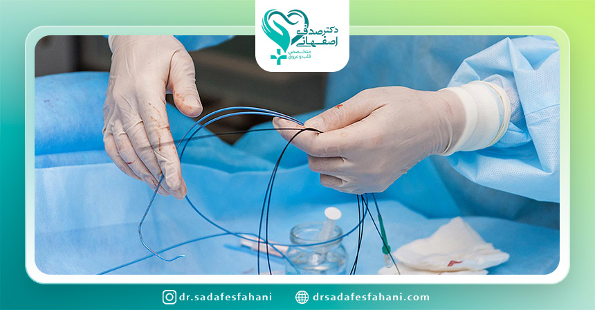 اقدامات بعد از انجام آنژیوگرافی
