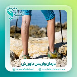 درمان واریس پا با ورزش