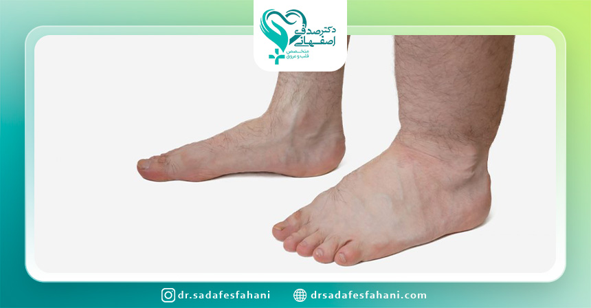 ادم محیطی چیست؟