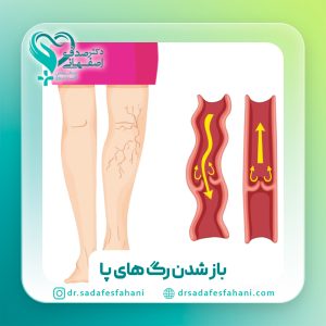 برای باز شدن رگهای پا چه بخوریم؟